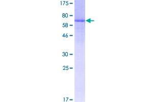Image no. 1 for ADP-Ribosyltransferase 3 (ART3) (AA 27-389) protein (GST tag) (ABIN1345758)