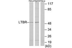 Western blot analysis of extracts from HeLa/HepG2 cells, using LTBR Antibody. (LTBR anticorps  (AA 11-60))