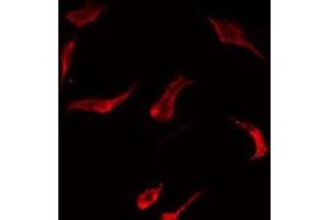 ABIN6275473 staining HT29 by IF/ICC. (RAB7L1 anticorps  (Internal Region))