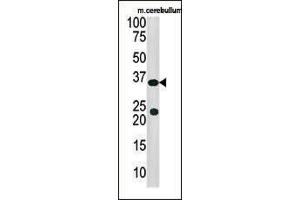 Image no. 1 for anti-Sulfotransferase Family 4A, Member 1 (SULT4A1) (both Isoforms), (N-Term) antibody (ABIN357819)