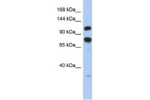 WB Suggested Anti-ZFR Antibody Titration:  0. (ZFR anticorps  (Middle Region))