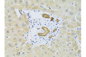 Immunohistochemistry of paraffin-embedded human liver injury using RAB27A Antibody (ABIN5970998) at dilution of 1/100 (40x lens). (RAB27A anticorps)