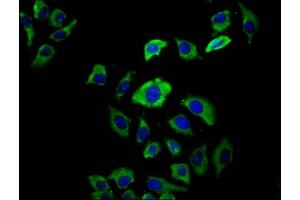 Immunofluorescence staining of A549 cells with ABIN7158397 at 1:66, counter-stained with DAPI. (EVC2 anticorps  (AA 30-199))