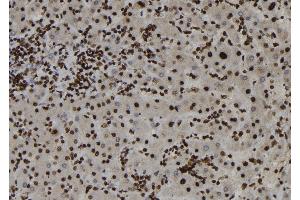ABIN6273187 at 1/100 staining Human liver tissue by IHC-P. (ZC3HAV1 anticorps  (Internal Region))