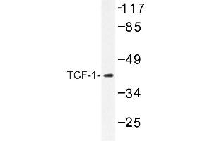 Image no. 1 for anti-HNF1 Homeobox A (HNF1A) antibody (ABIN272184) (HNF1A anticorps)