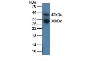 Detection of CTSG in Human MCF7 Cells using Polyclonal Antibody to Cathepsin G (CTSG) (Cathepsin G anticorps  (AA 21-255))