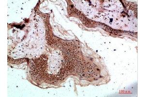 Immunohistochemical analysis of paraffin-embedded human-skin, antibody was diluted at 1:200 (TPSD1 anticorps  (AA 51-100))