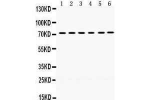 Western Blotting (WB) image for anti-LIM Domain Kinase 2 (LIMK2) (AA 596-635), (C-Term) antibody (ABIN3043412) (LIMK2 anticorps  (C-Term))