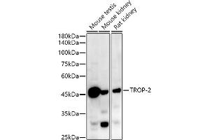 Western blot analysis of extracts of various cell lines, using TROP-2 antibody (ABIN7271103) at 1:1000 dilution.