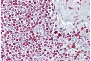 Anti-ATOH1 / MATH-1 antibody IHC staining of human spleen.