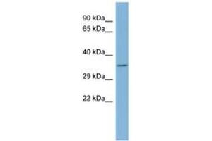 Image no. 1 for anti-Tetratricopeptide Repeat Domain 35 (TTC35) (AA 107-156) antibody (ABIN6741756) (TTC35 anticorps  (AA 107-156))