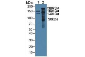 Rabbit Capture antibody from the kit in WB with Positive Control: Lane1: Mouse Serum; Lane2: Mouse Heart Tissue. (Thrombospondin 1 Kit CLIA)