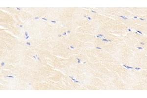 Detection of BMP3 in Bovine Skeletal muscle Tissue using Monoclonal Antibody to Bone Morphogenetic Protein 3 (BMP3)