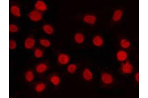 ABIN6268876 staining K562 by IF/ICC.