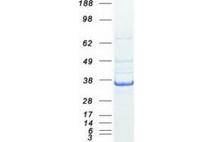 Validation with Western Blot