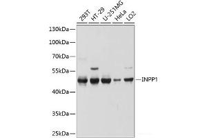Western blot analysis of extracts of various cell lines using INPP1 Polyclonal Antibody at dilution of 1:1000. (INPP1 anticorps)