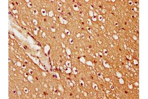 IHC image of ABIN7173447 diluted at 1:200 and staining in paraffin-embedded human brain tissue performed on a Leica BondTM system. (TRIM45 anticorps  (AA 428-573))