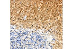 IHC analysis of mGluR1/GRM1 using anti-mGluR1/GRM1 antibody (ABIN7600912).