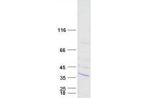 Validation with Western Blot