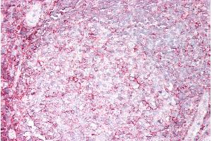 ABIN5539556 (5µg/ml) staining of paraffin embedded Human Tonsil.