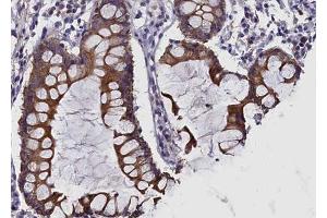 ABIN6269120 at 1/100 staining human colon tissue sections by IHC-P. (c-MET anticorps  (Internal Region))