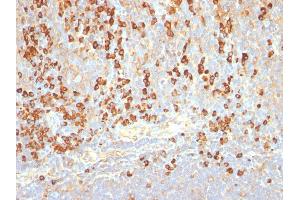 Formalin-fixed, paraffin-embedded human Tonsil stained with Plasma Cell Marker Monoclonal Antibody (LIV3G11). (Plasma Cell Marker anticorps)