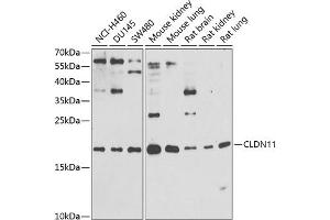Western blot analysis of extracts of various cell lines, using CLDN11 antibody (ABIN6133643, ABIN6138675, ABIN6138676 and ABIN6216120) at 1:1000 dilution. (Claudin 11 anticorps  (AA 1-100))