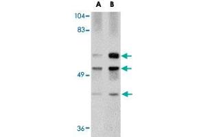 Western blot analysis of GALNT10 in rat brain tissue lysate with GALNT10 polyclonal antibody  at (A) 1 and (B) 2 ug/mL . (GALNT10 anticorps  (N-Term))