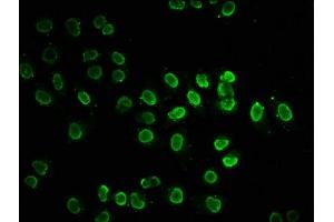 Immunofluorescence staining of Hela cells (treated with 30mM sodium butyrate for 4h) with ABIN7139170 at 1:7.