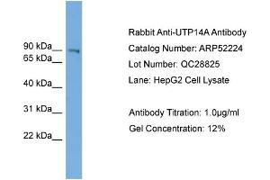 WB Suggested Anti-UTP14A  Antibody Titration: 0. (UTP14A anticorps  (N-Term))