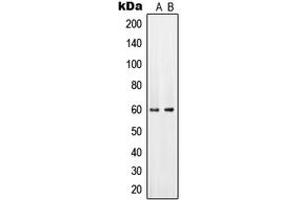 Western blot analysis of PAHT expression in HeLa (A), mouse brain (B) whole cell lysates. (SLC22A6 anticorps  (Center))