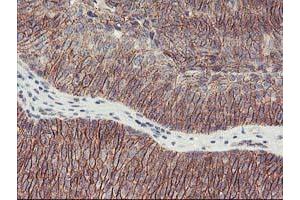 Image no. 3 for anti-Arachidonate 15-Lipoxygenase (ALOX15) antibody (ABIN1496359)