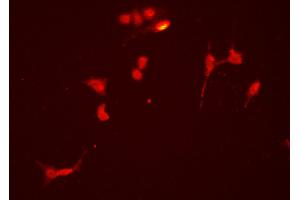 ABIN6275915 staining HEPG2 cells by ICC/IF. (alpha 1 Adrenergic Receptor anticorps  (Internal Region))