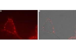 Expression of TRPV4 in human U-87 cells - Cell surface detection of TRPV4 in live intact human brain glioblastoma U-87 cells.