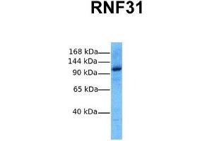 Host:  Rabbit  Target Name:  RNF31  Sample Tissue:  Human MCF7  Antibody Dilution:  1. (RNF31 anticorps  (Middle Region))