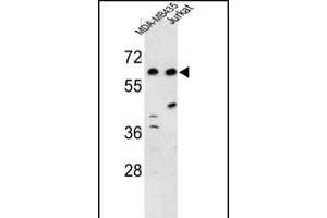 Western blot analysis of C19orf26 Antibody (Center) (ABIN653222 and ABIN2842757) in MDA-M, Jurkat cell line lysates (35 μg/lane). (C19orf26 anticorps  (AA 423-450))