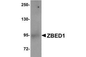 Western blot analysis of ZBED1 in A549 cell lysate with this product at 1 μg/ml.