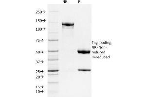 SDS-PAGE Analysis Purified Ferritin, Heavy Chain Mouse Monoclonal Antibody (FTH/2081).