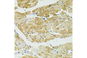 Immunohistochemistry of paraffin-embedded rat heart using RALBP1 antibody.