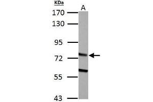 WB Image HADHA antibody detects HADHA protein by Western blot analysis. (HADHA anticorps  (C-Term))