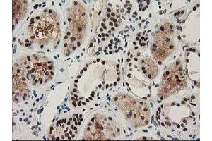 Immunohistochemical staining of paraffin-embedded Human Kidney tissue using anti-NHEJ1 mouse monoclonal antibody. (NHEJ1 anticorps)