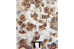 Formalin-fixed and paraffin-embedded human testis tissue reacted with NANOG polyclonal antibody  , which was peroxidase-conjugated to the secondary antibody, followed by DAB staining. (Nanog anticorps  (Internal Region))