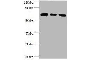 Western blot All lanes: HSPA2 antibody at 6 μg/mL Lane 1: A431 whole cell lysate Lane 2: Hela whole cell lysate Lane 3: Rat brain tissue Secondary Goat polyclonal to rabbit IgG at 1/10000 dilution Predicted band size: 70 kDa Observed band size: 70 kDa (HSPA2 anticorps  (AA 400-639))
