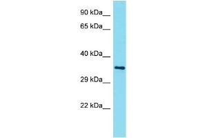Host: Rabbit Target Name: AMMECR1L Sample Type: NCI-H226 Whole Cell lysates Antibody Dilution: 1. (AMMECR1-Like anticorps  (N-Term))