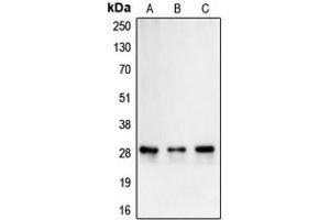 Western blot analysis of Carbonic Anhydrase 2 expression in Caco2 (A), K562 (B), Caki1 (C) whole cell lysates. (CA2 anticorps  (C-Term))