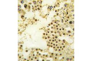 Image no. 1 for anti-Zinc Finger Protein 219 (ZNF219) (N-Term) antibody (ABIN357352) (ZNF219 anticorps  (N-Term))