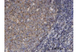 Immunoperoxidase of monoclonal antibody to MSN on formalin-fixed paraffin-embedded human tonsil.