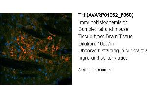 Image no. 3 for anti-TH (N-Term) antibody (ABIN2792118) (TH anticorps  (N-Term))