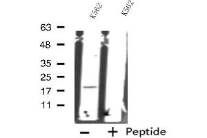 Western blot analysis of extracts from K562 cells, using RPS18 antibody. (RPS18 anticorps)