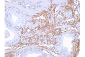 Formalin-fixed, paraffin-embedded human Prostate stained with Decorin Mouse Monoclonal Antibody (DCN/3523). (Decorin anticorps  (AA 212-336))
